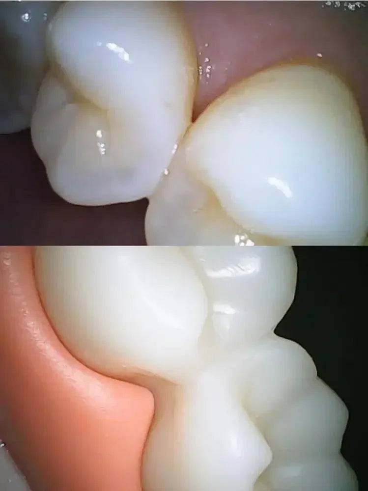 Câmera Intraoral sem Fio