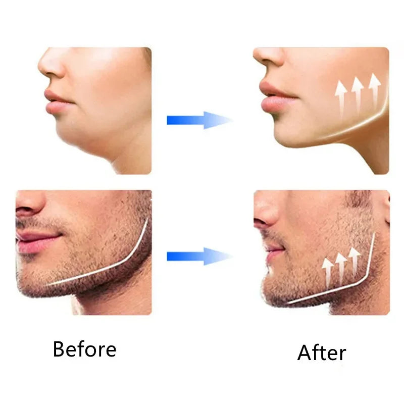 Silicone para Exercício e Definição de Mandíbula