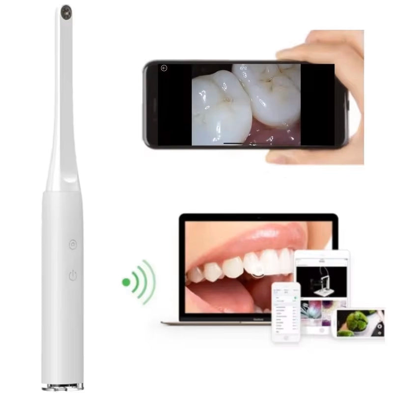 Câmera Intraoral sem Fio