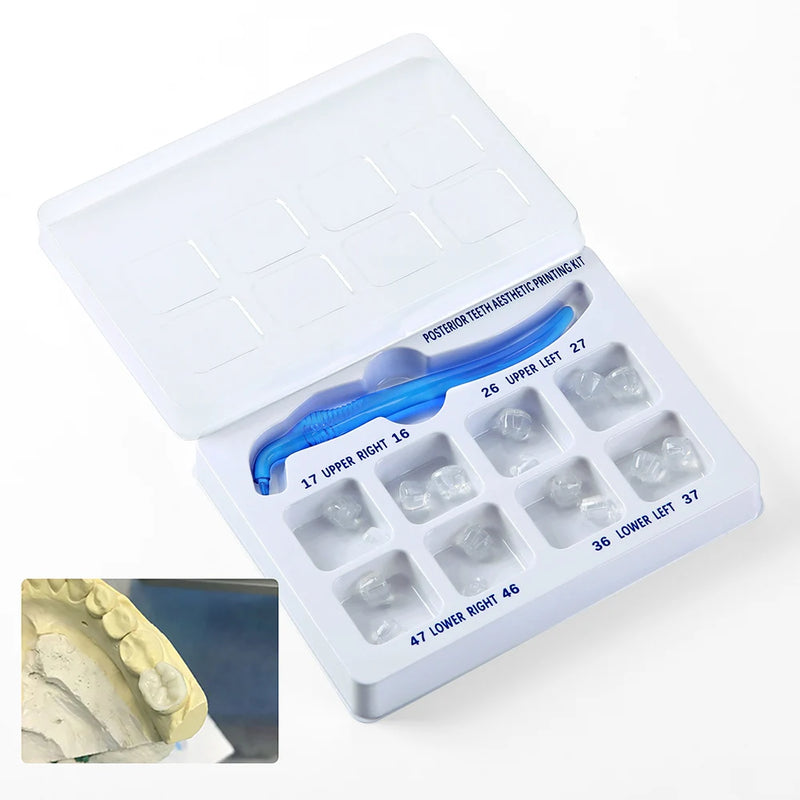 Molde e Matriz Oclusal de Poliéster para restauração em Resina Composta