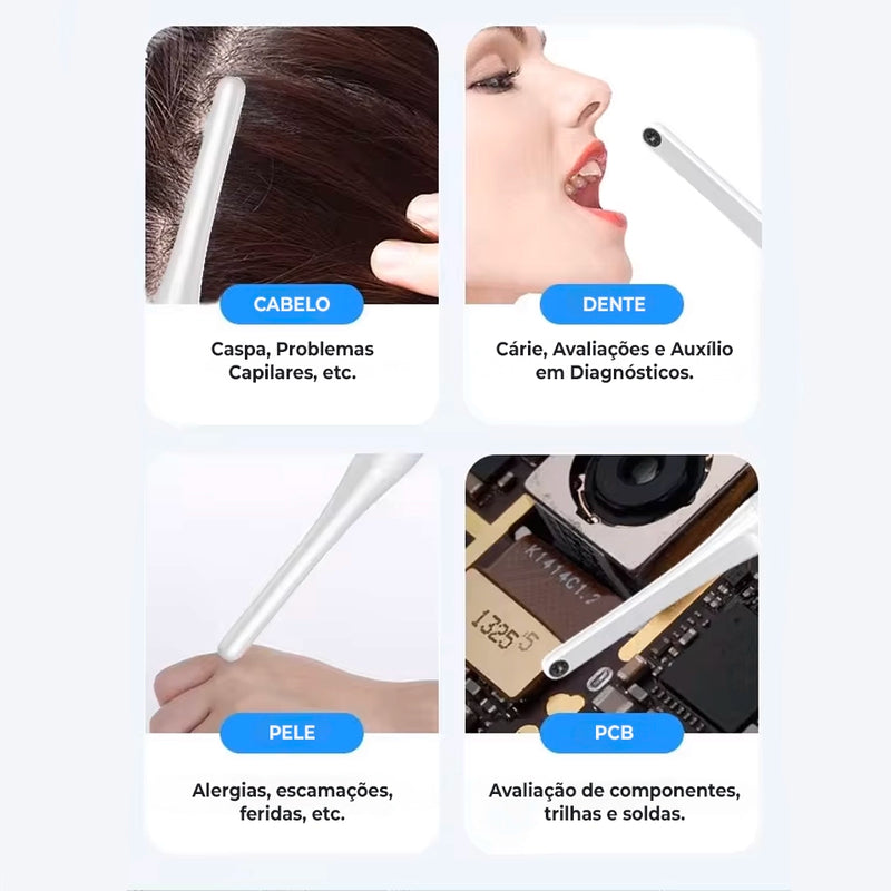 Câmera Intraoral sem Fio